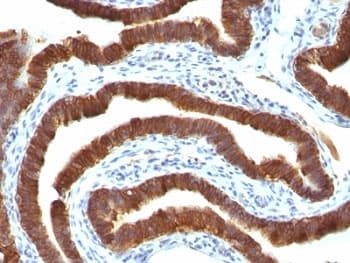 KRT19 / CK19 / Cytokeratin 19 Antibody (clone Ks19.1, Ready-to-Use)