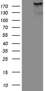 Monoclonal Mouse anti-Human IQGAP1 Antibody (clone OTI6E1, Carrier-free, aa464-609, IHC, WB)