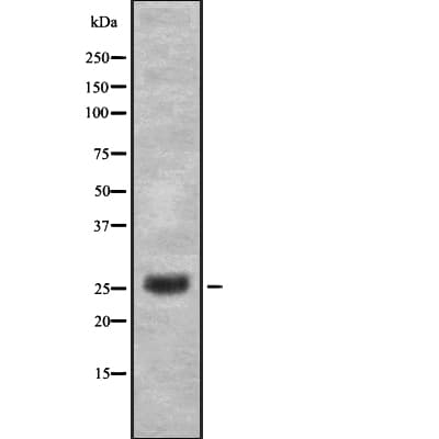 Polyclonal Rabbit anti-Human UBTD2 Antibody (IF, WB)