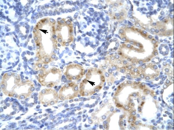TBX1 Antibody (aa396-445, HRP)
