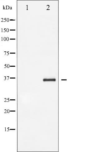 NFKBIB / IKB Beta / IKBB Antibody (phospho-Ser23)