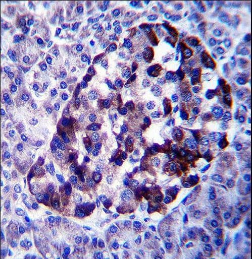 Polyclonal Rabbit anti-Human TRIM1 / MID2 Antibody (aa690-717, IHC, WB)