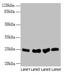 Polyclonal Rabbit anti-Rat SOCS3 Antibody (WB)