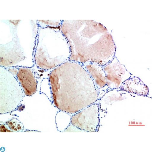 TTR / Transthyretin Antibody