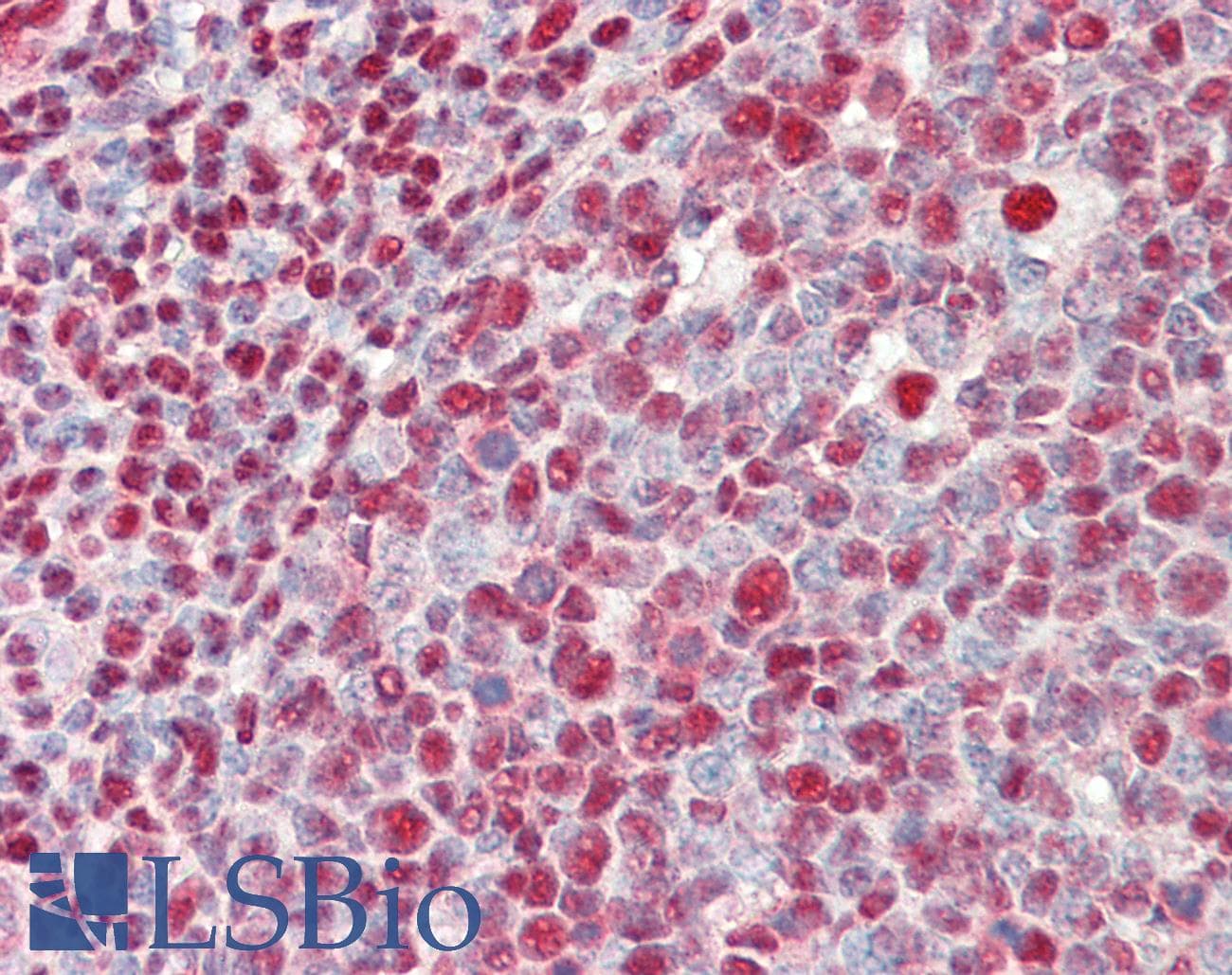 IHC-plus™ Polyclonal Rabbit anti-Human RPA2 / RFA2 / RPA34 Antibody (aa225-C-term, IHC, WB)