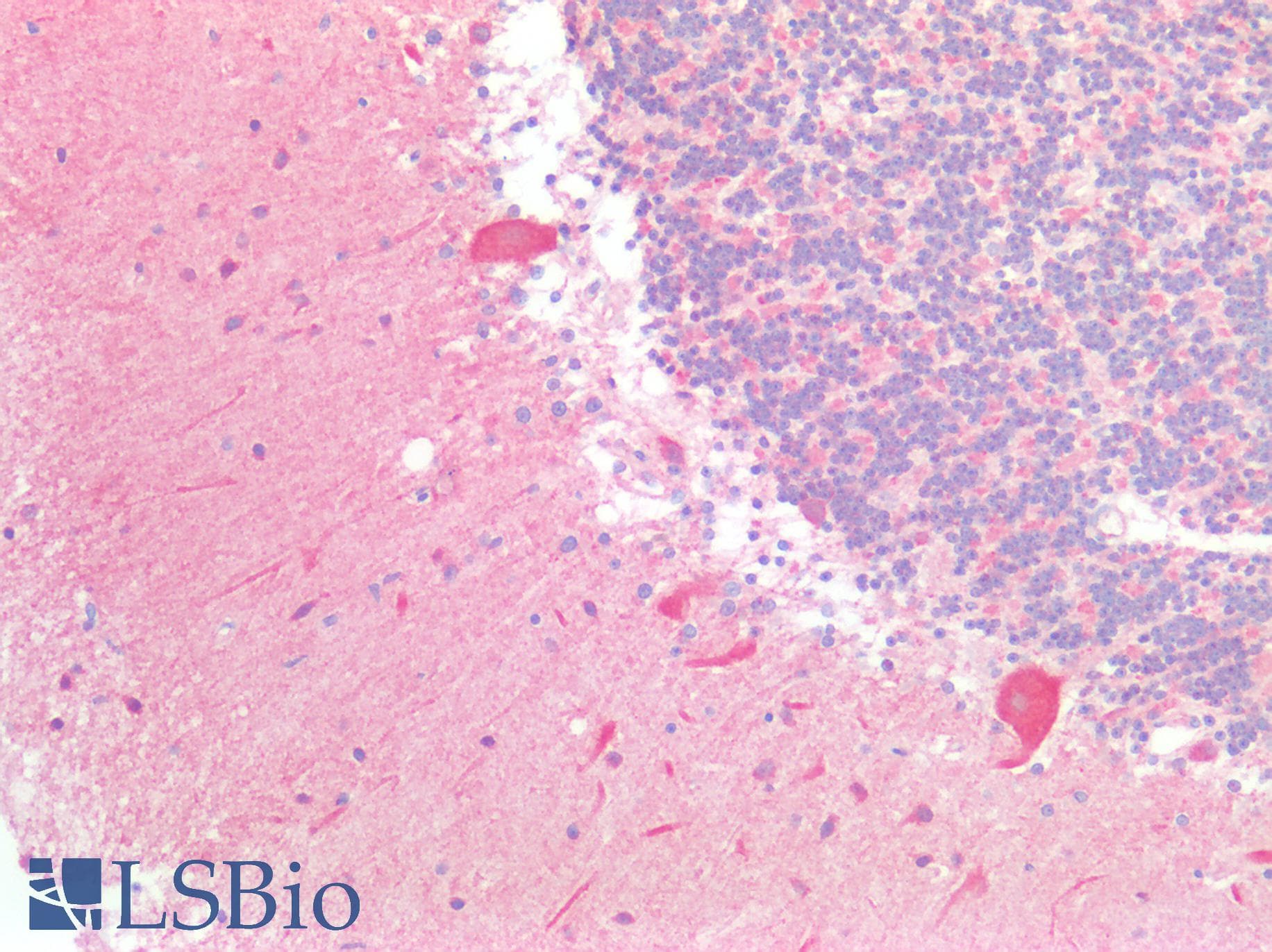 PathPlus™ BCKDHA / BCKDE1A Antibody