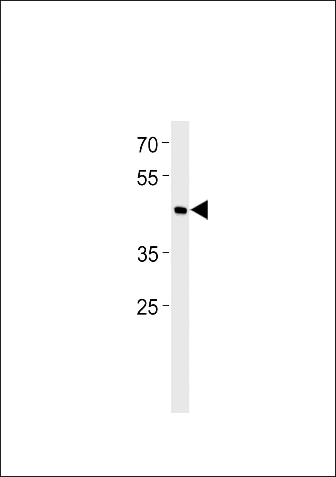 BHLHE41 / BHLHB3 / SHARP1 Antibody (aa17-46)