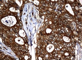 NME1 / NM23 Antibody (clone OTI7F6)