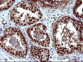 UPRT Antibody (clone OTI2D1)