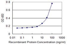 IHC-plus™ VDAC1 / PORIN Antibody (clone 2A8)