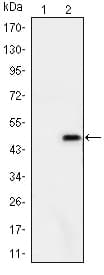 ATXN1 / SCA1 Antibody (clone 2F5)