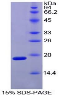 Chicken HIF1A / HIF1 Alpha Protein (Recombinant His)