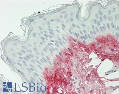IHC-plus™ POSTN / Periostin Antibody (aa538-781, clone 2B2)