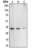 Polyclonal Rabbit anti-Human CASP3 / Caspase 3 Antibody (N-Terminus, WB)