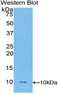 FBLN5 / Fibulin 5 Antibody (aa170-243)
