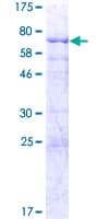 Human SLC25A24 / APC1 Protein (Recombinant GST)