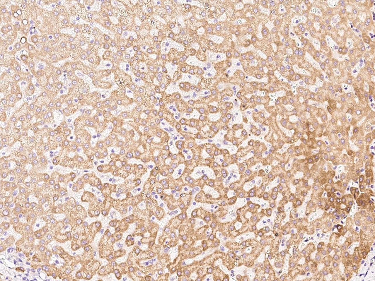 AADAC Antibody (Preservative Free)
