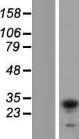 TIP30 / HTATIP2 Protein (Over-Expression Lysate Myc-DDK (Flag))
