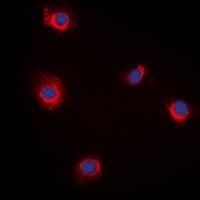 Polyclonal Rabbit anti-Human RBP5 Antibody (N-Terminus, IHC, IF, WB)