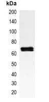 RELA / NFKB p65 Antibody
