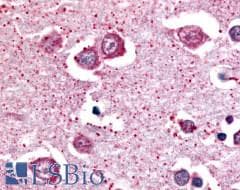PathPlus™ Polyclonal Rabbit anti-Human NPBWR2 / GPR8 Antibody (Cytoplasmic Domain, IHC)