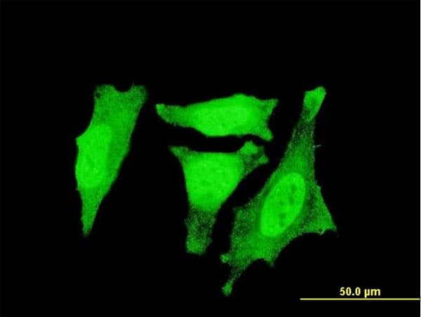 IHC-plus™ Monoclonal Mouse anti-Human RGS3 Antibody (clone 1E8-C7, IHC, IF, WB)