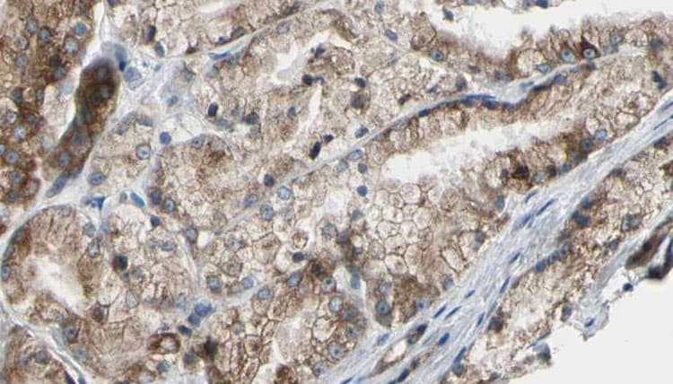PIK3C2G Antibody