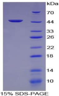 Pig Alpha-Fetoprotein (Recombinant His-GST)