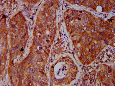 Polyclonal Rabbit anti-Human BICD2 Antibody (IHC, IF, WB)