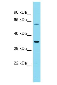 Polyclonal Rabbit anti-Human GOLGA6L4 Antibody (aa94-143, WB)