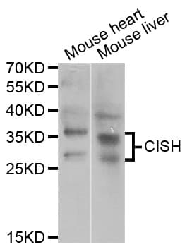 Polyclonal Rabbit anti-Human CISH / SOCS Antibody (IHC, WB)