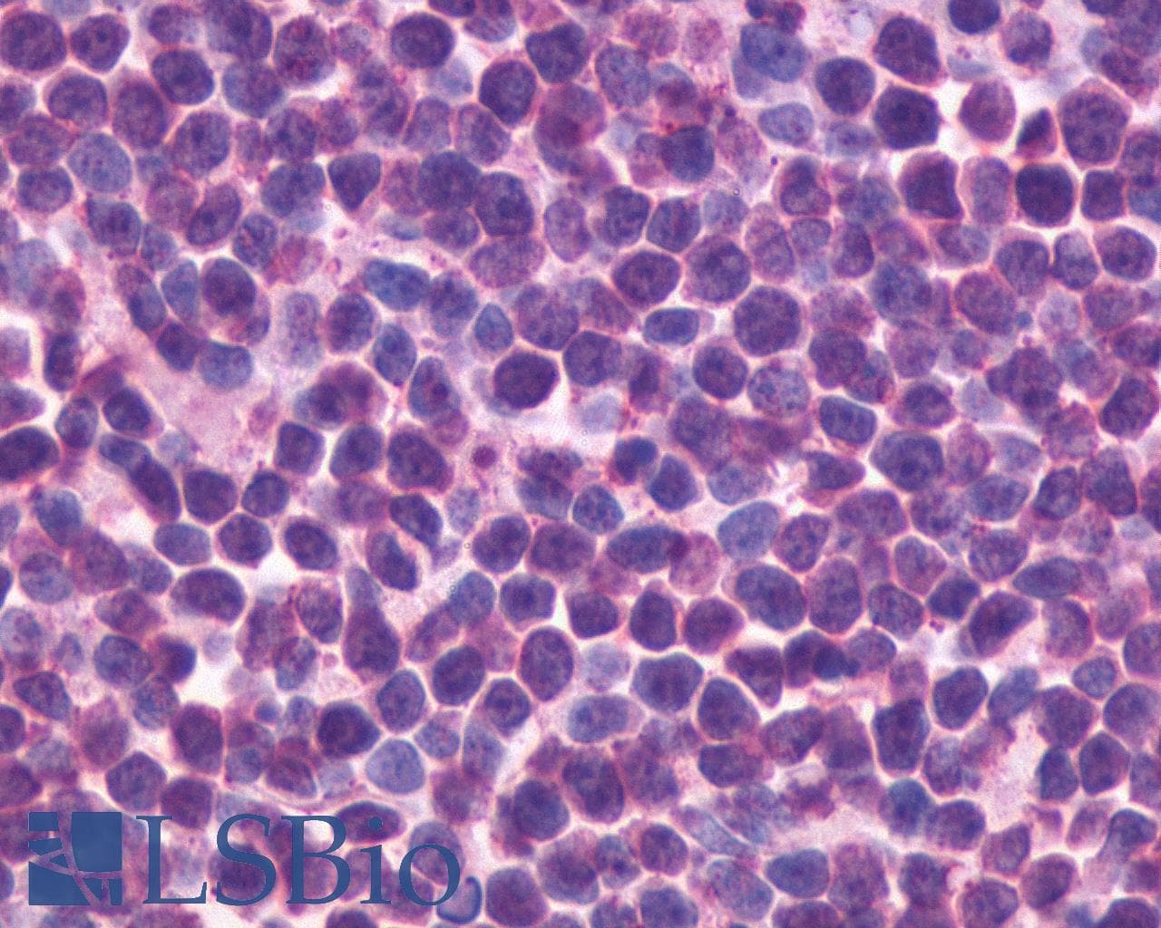 IHC-plus™ CXCR5 Antibody (Cytoplasmic Domain)