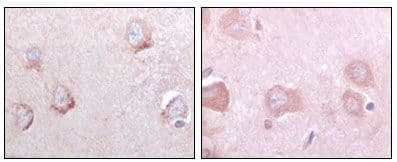 Monoclonal Mouse anti-Human SORL1 Antibody (clone 3B6B11, IHC, IF, WB)