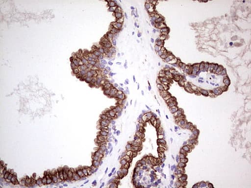 Peripherin Antibody (clone OTI3F4)