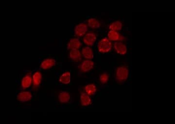 SUPT16H / FACTP140 Antibody