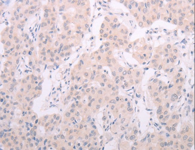 TSH Receptor / TSHR Antibody