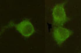 Monoclonal Mouse anti-Human Mannose Phosphate Isomerase Antibody (WB)