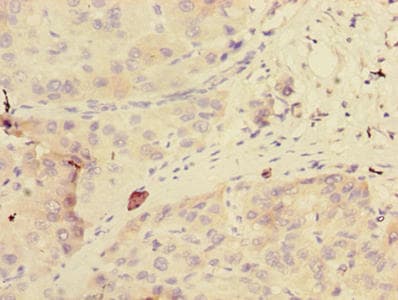 GDPD2 / GDE3 Antibody