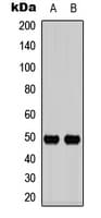 IL13RA1 / IL13R Alpha 1 Antibody (C-Terminus)