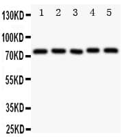 TEC Antibody (aa612-631)