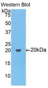 PathPlus™ COL8A1 / Collagen VIII Alpha 1 Antibody (aa583-743)