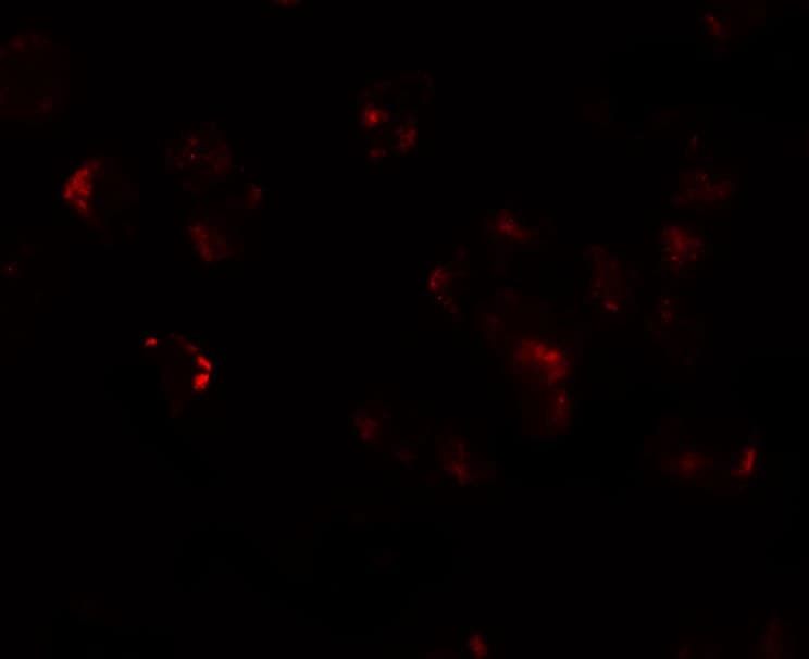 IHC-plus™ AFAP1L1 Antibody