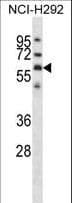 Polyclonal Rabbit anti-Human GPC3 / Glypican 3 Antibody (aa465-494, WB)