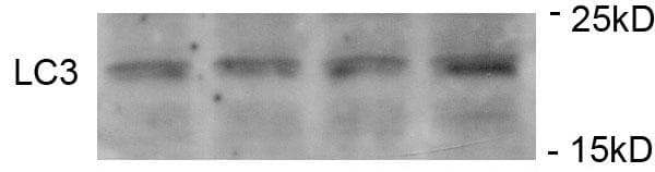 Polyclonal Rabbit anti-Human MAP1LC3A / LC3A Antibody (phospho-Ser12, WB)