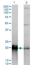Monoclonal Mouse anti-Human KRAS Antibody (clone 3B10-2F2, IF, WB)