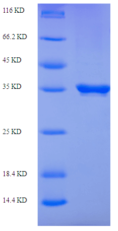 Coptis japonica S-norcoclaurine synthase 2 (PR10A) Protein (Recombinant His-SUMO)