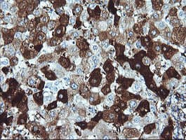 Monoclonal Mouse anti-Human DPCD Antibody (clone OTI8A12, IHC, IF, WB)