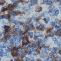 NCF1 / p47phox / p47 phox Antibody (C-Terminus)