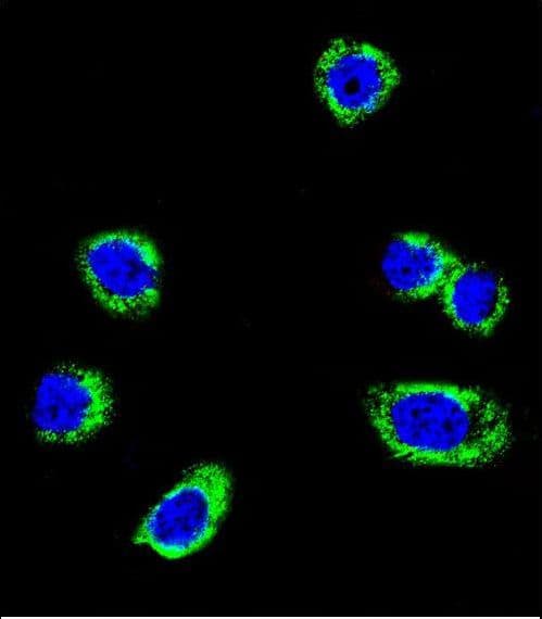 BRAF / B-Raf Antibody (Ser445)