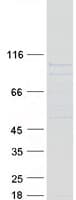 Human LCA3 / SPATA7 Protein (Recombinant Myc-DDK (Flag))